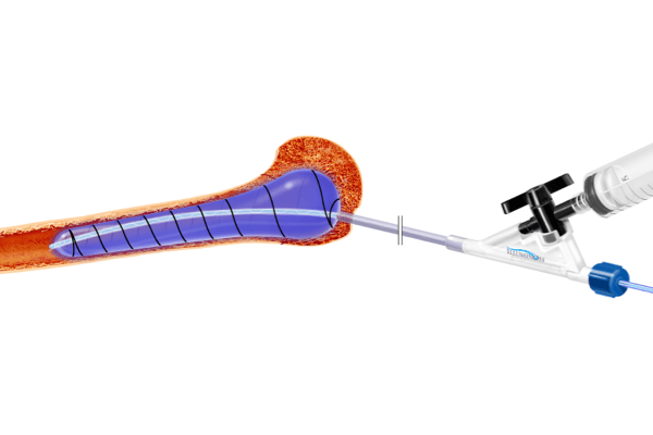 Older patient walking with a cane assisted by younger woman